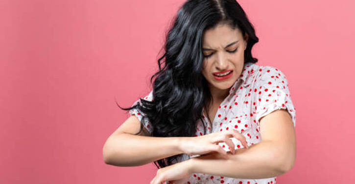 অ্যালার্জি থেকে মুক্তির ঘরোয়া উপায়