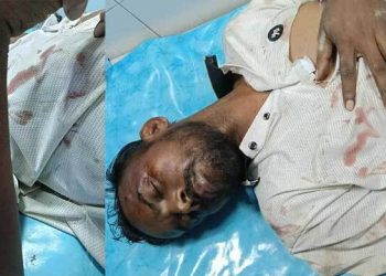হিরো আলমের অবস্থা ‘আশঙ্কাজনক’