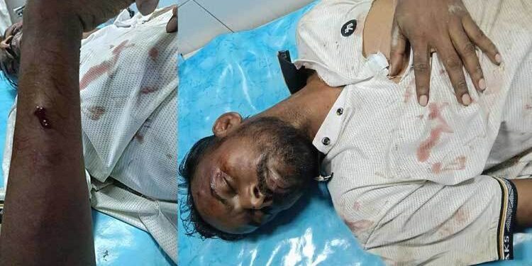 হিরো আলমের অবস্থা ‘আশঙ্কাজনক’