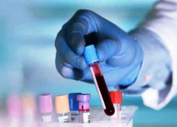 রক্তের গ্রুপের সঙ্গেও আছে স্ট্রোকের সম্পর্ক, বেশি ঝুঁকিতে যারা!