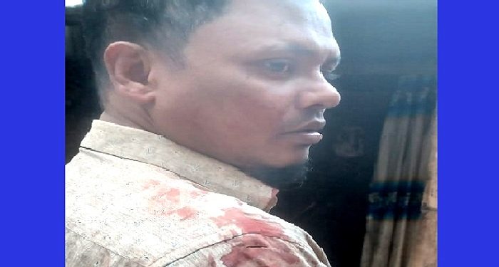 রামু স্বেচ্ছাসেবকলীগ নেতা আলাউদ্দিন আটক