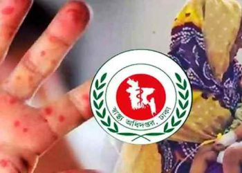 দেশে হাম ও হামের উপসর্গ নিয়ে আরও ৯ শিশুর মৃত্যু