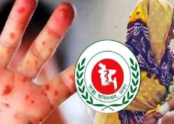 হাম উপসর্গ নিয়ে ২৪ ঘণ্টায় মৃত্যু ৩, আক্রান্ত ১১৩৫