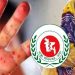 হাম উপসর্গ নিয়ে ২৪ ঘণ্টায় মৃত্যু ৩, আক্রান্ত ১১৩৫