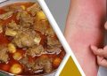 গরুর মাংস খেয়ে অ্যালার্জি হলে যা করবেন