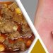গরুর মাংস খেয়ে অ্যালার্জি হলে যা করবেন